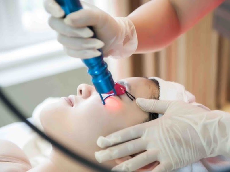 Dùng tia laser để làm đẹp