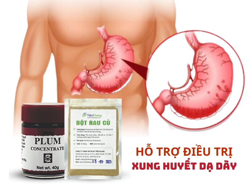 Các trợ phương thảo dược hỗ trợ điều trị bệnh xung huyết dạ dày