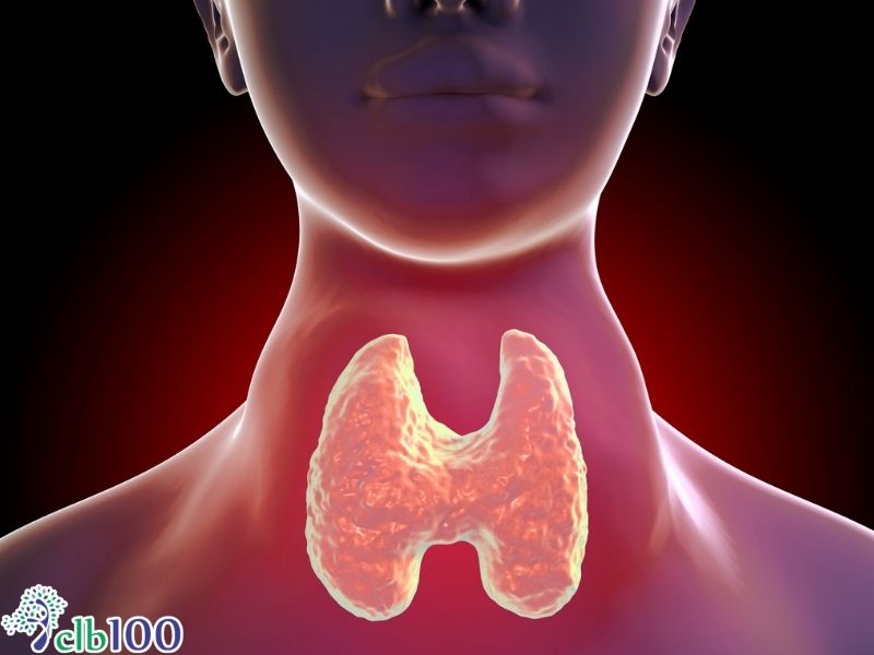 Nguyên nhân gốc rễ gây ra bệnh cường giáp