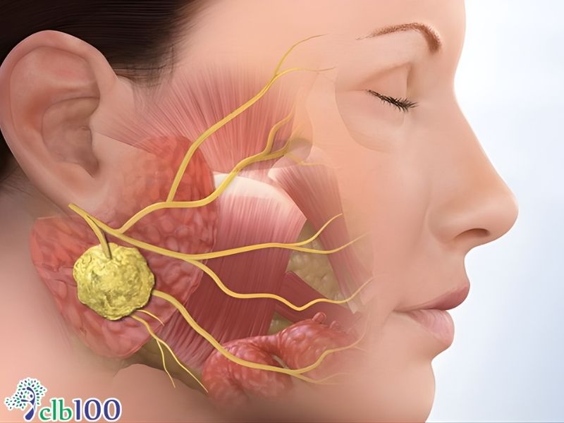 Quai bị có thể gây biến chứng tổn thương nội tạng và thần kinh sọ não