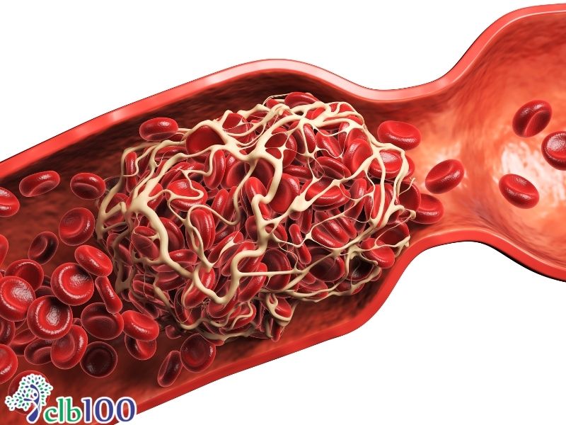 Vì sao thiếu máu không chỉ do thiếu sắt?