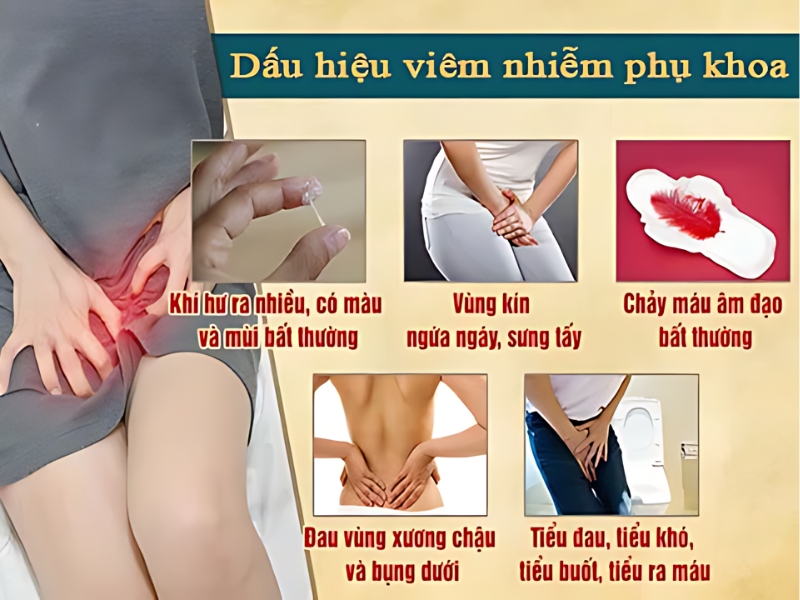 Dấu hiệu viêm nhiễm phụ khoa