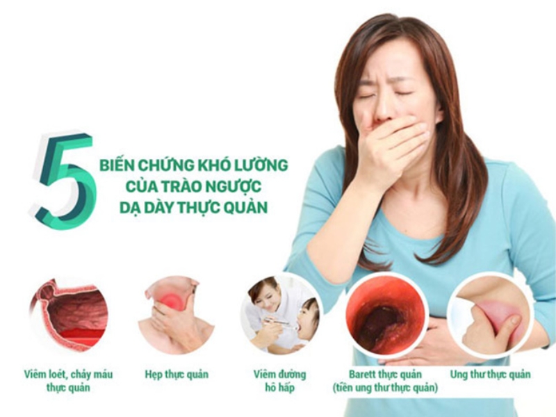 Bệnh trào ngược dạ dày