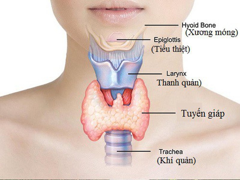 Nguyên nhân mắc bệnh tuyến giáp 