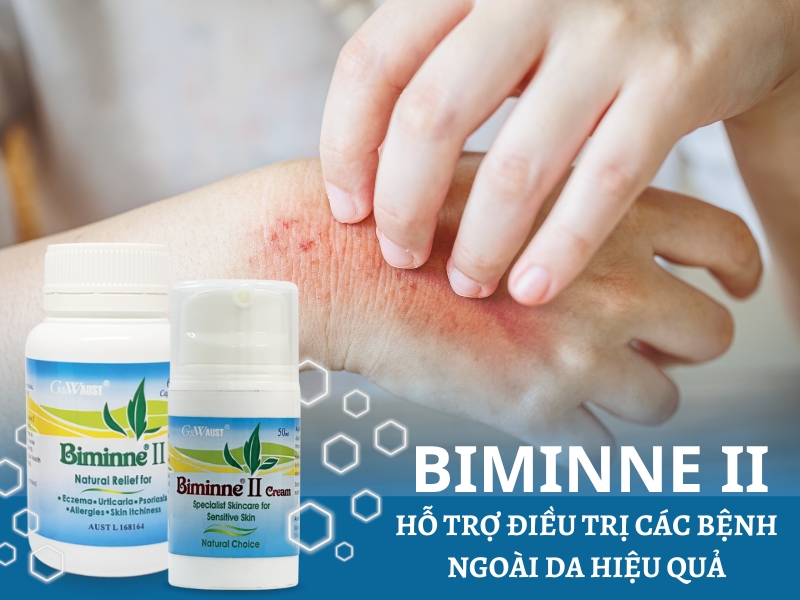 Biminne II - Trowh phương thảo dược hỗ trợ điều trị các bệnh ngoài da