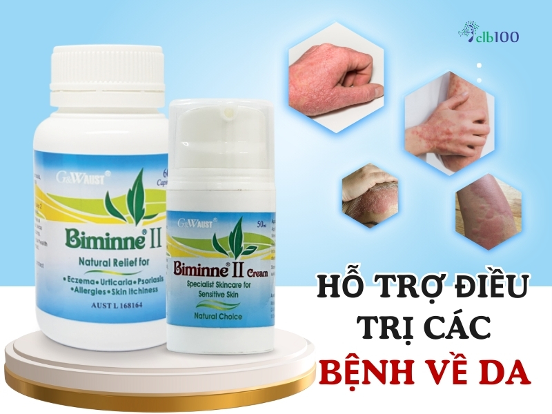 Biminne II uông và bôi hỗ trợ điều trị các bệnh về da hiệu quả