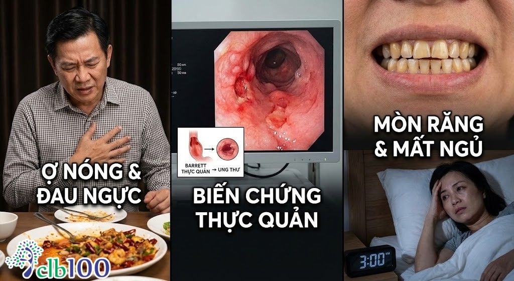 Trào ngược dạ dày ảnh hưởng sức khỏe ra sao?