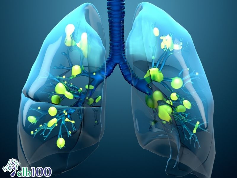 Các biến chứng hô hấp do virus gây ra có thể gây ảnh hưởng đến phổi