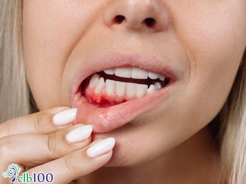 Các biển hiện nguy hiểm cho thấy rằng đang thiếu vitamin C nghiêm trọng