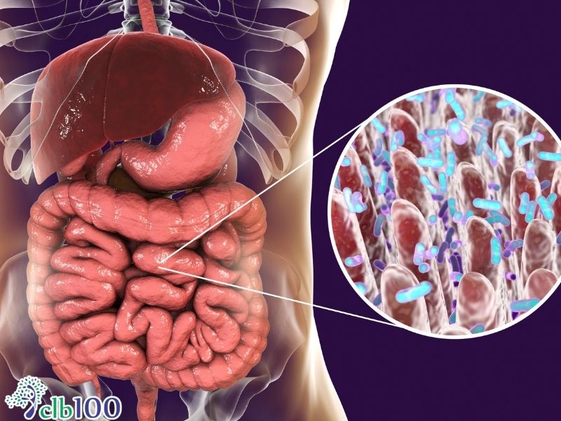 Đau ruột thừa là gì? Cơ chế sinh bệnh theo y học hiện đại