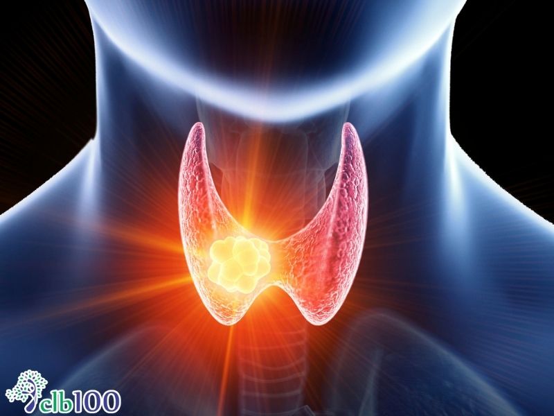 Định nghĩa về bệnh suy giáp