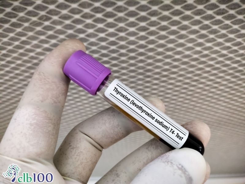 Sử dụng hormone Levothyroxine thay thế để điều trị suy giáp