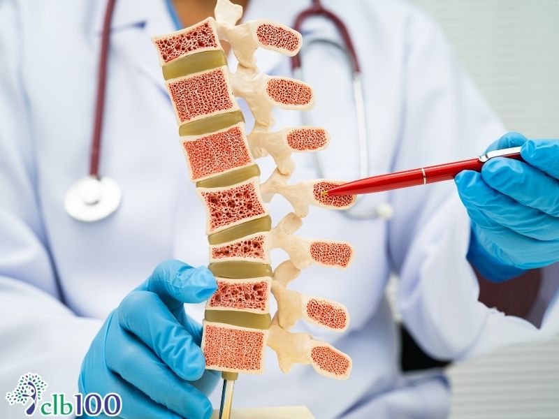 Hệ luỵ từ việc suy giảm mật độ xương