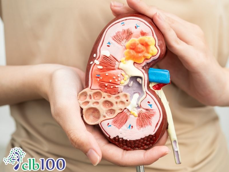 Người có vấn đề về thận không nên sử dụng chanh muối mật ong