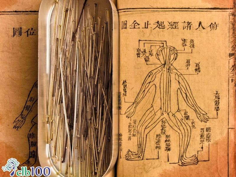 Nguồn gốc lịch sử và cơ chế hoạt động của châm cứu