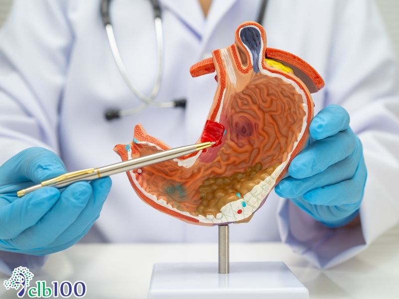 Người có bệnh lý nền viêm loét dạ dày nặng không được tự ý tuyệt thực