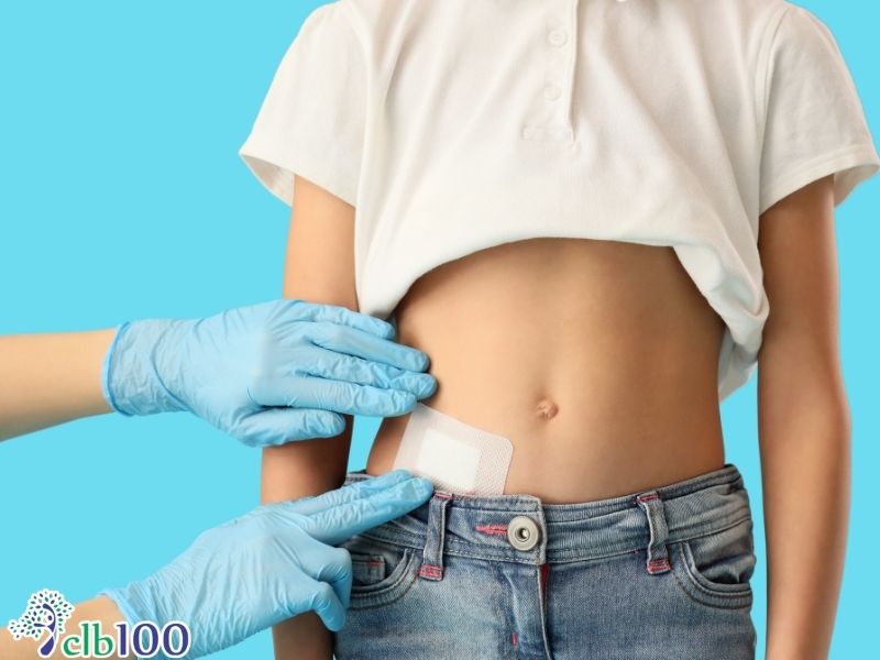 Phương pháp điều trị ngoại khoa tiêu chuẩn hiện nay