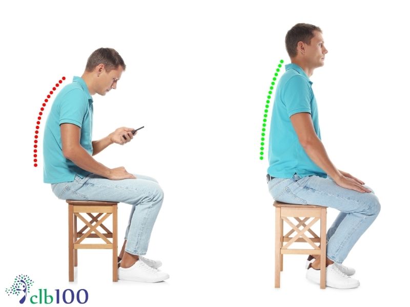 Tư thế làm việc sai lệch khiến dân văn phòng ngày càng mắc bệnh thoát vị đĩa đệm nhiều?