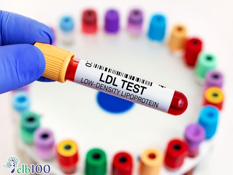 Trứng gà không gây tăng mỡ máy xấu như lầm tưởng