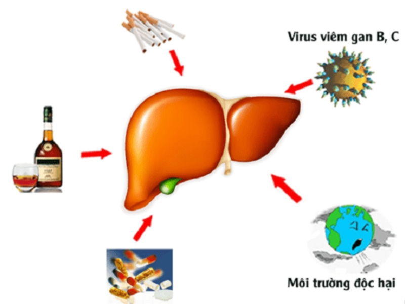 Nguyên nhân mắc bệnh gan