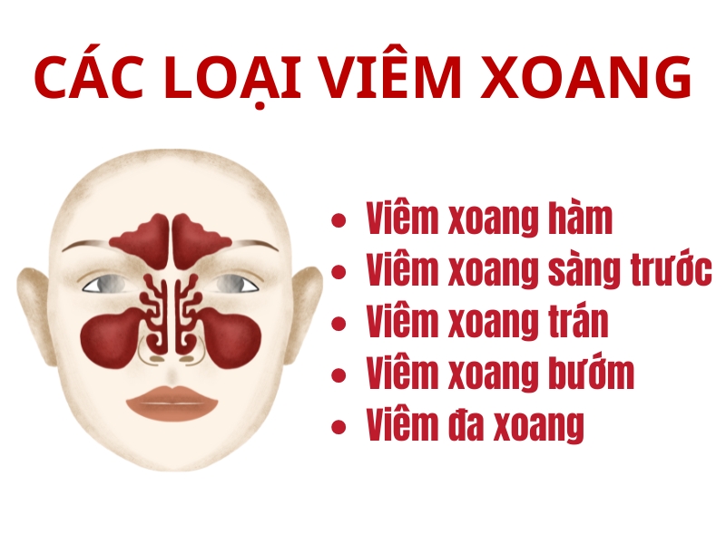 Nguyên nhân mắc bệnh viêm xoang