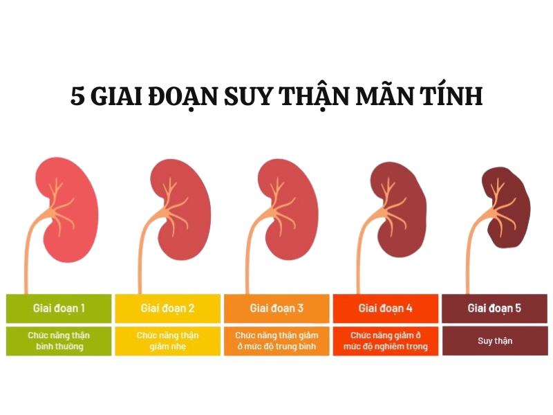 Các giai đoạn suy thận mãn tính