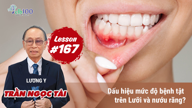 Lesson #167: Dấu hiệu mức độ bệnh tật trên lưỡi và nướu răng? 02-03-2026