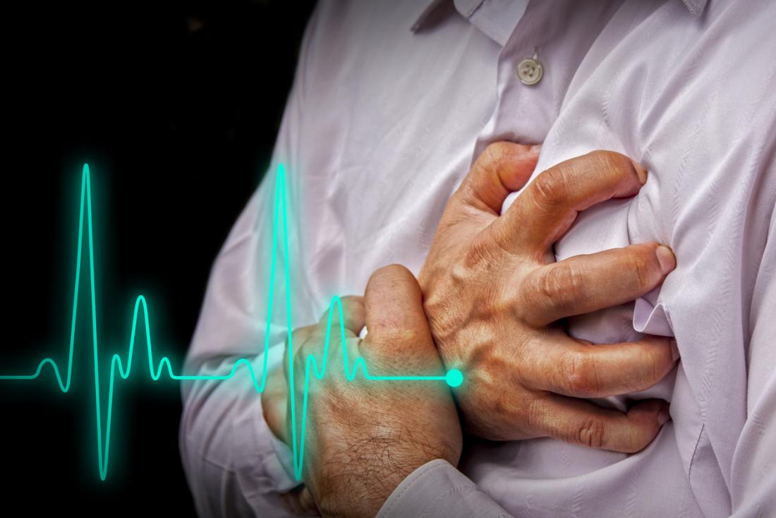 Rối loạn hoạt động điện của tim làm huyết áp giảm, nhịp tim nhanh